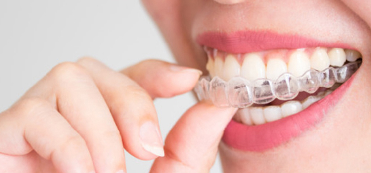 Invisible braces at Sriram Dental Nanganallur